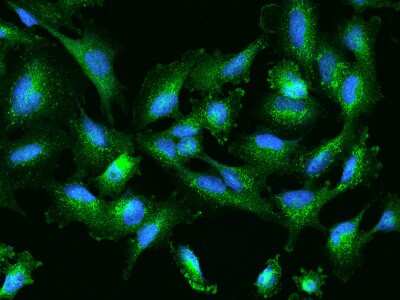 Immunocytochemistry/ Immunofluorescence: SLC26A2 Antibody [NBP2-97678]