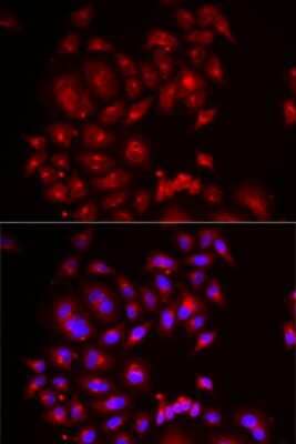 Immunocytochemistry/ Immunofluorescence: SLC26A2 Antibody - BSA Free [NBP3-05097]