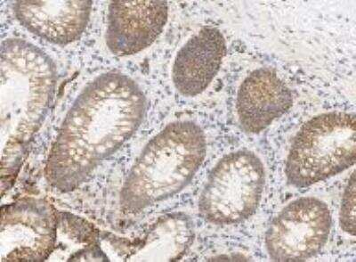 Immunohistochemistry: SLC26A2 Antibody [NBP3-12557]