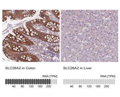 Immunohistochemistry-Paraffin: SLC26A2 Antibody [NBP2-49271]