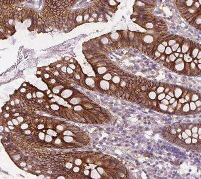 Immunohistochemistry-Paraffin: SLC26A2 Antibody [NBP2-49271]