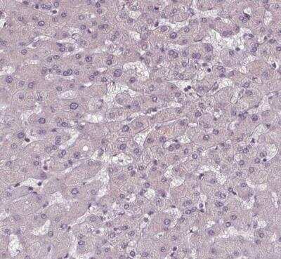 Immunohistochemistry-Paraffin: SLC26A2 Antibody [NBP2-49271]