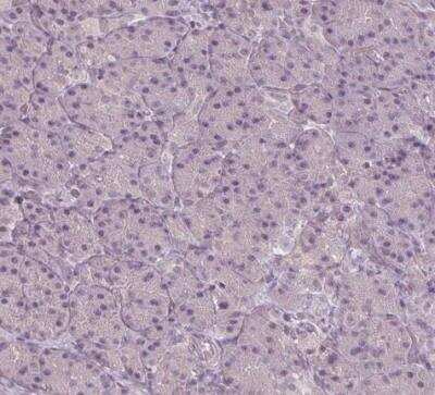 Immunohistochemistry-Paraffin: SLC26A2 Antibody [NBP2-49271]