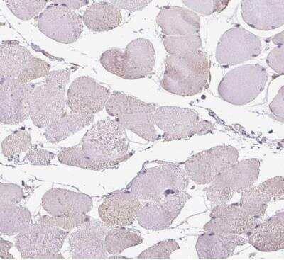 Immunohistochemistry-Paraffin: SLC26A2 Antibody [NBP2-49271]