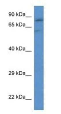 Western Blot: SLC26A2 Antibody [NBP1-80522]