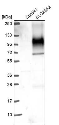 Western Blot: SLC26A2 Antibody [NBP2-49271]