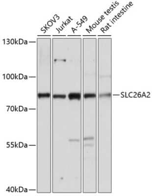 Western Blot: SLC26A2 AntibodyAzide and BSA Free [NBP2-93651]