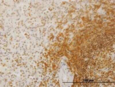 Immunohistochemistry-Paraffin: SLC26A3 Antibody (2E3) [H00001811-M01]