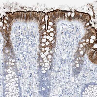 Immunohistochemistry-Paraffin: SLC26A3 Antibody [NBP1-84450]