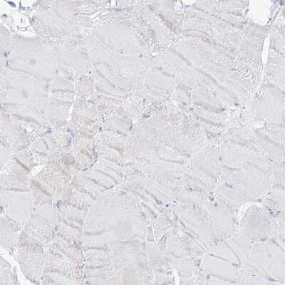 Immunohistochemistry-Paraffin: SLC26A3 Antibody [NBP1-84450]