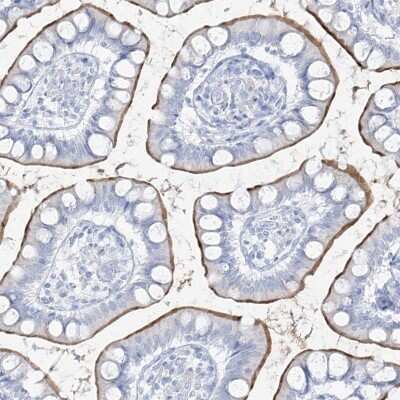 Immunohistochemistry-Paraffin: SLC26A3 Antibody [NBP1-84450]