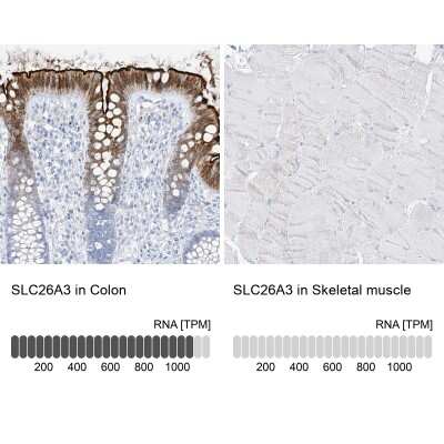 Immunohistochemistry-Paraffin: SLC26A3 Antibody [NBP1-84450]