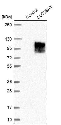 Western Blot: SLC26A3 Antibody [NBP1-84450]