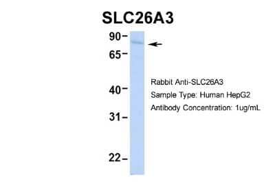 Western Blot: SLC26A3 Antibody [NBP2-85745]