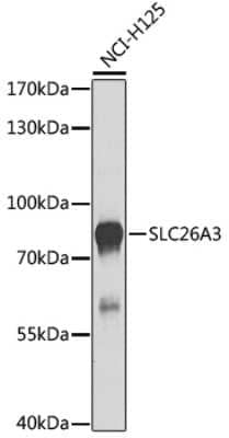 Western Blot: SLC26A3 AntibodyBSA Free [NBP3-05079]