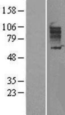 Western Blot: SLC26A3 Overexpression Lysate [NBL1-16077]