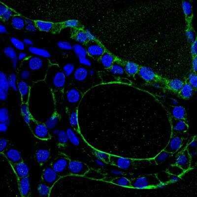 Immunohistochemistry-Frozen: SLC26A4 Antibody [NBP1-85237]