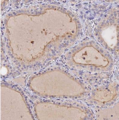 Immunohistochemistry-Paraffin: SLC26A4 Antibody [NBP1-85237]