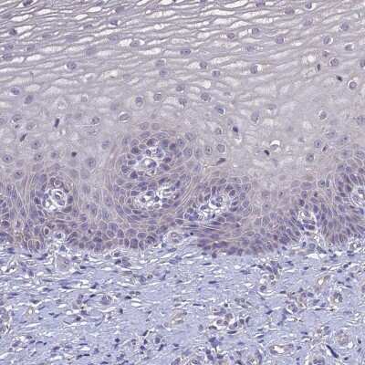 Immunohistochemistry-Paraffin: SLC26A4 Antibody [NBP1-85237]
