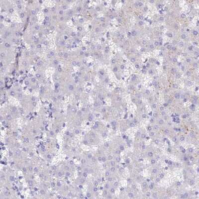 Immunohistochemistry-Paraffin: SLC26A4 Antibody [NBP1-85237]