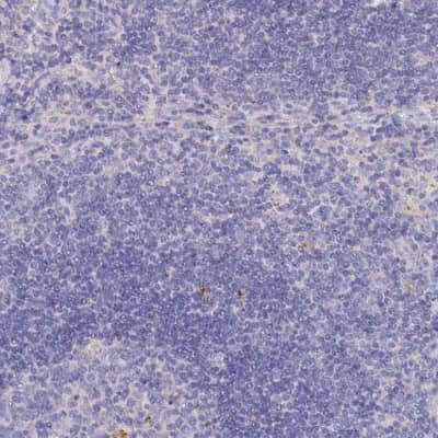 Immunohistochemistry-Paraffin: SLC26A4 Antibody [NBP1-85237]