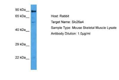 Western Blot: SLC26A4 Antibody [NBP2-88291]