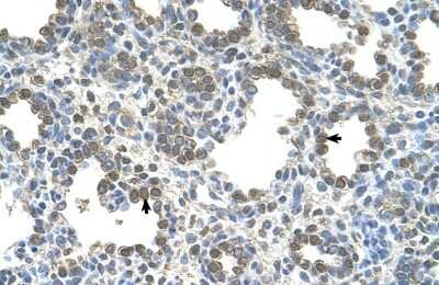 Immunohistochemistry-Paraffin: SLC26A5 Antibody [NBP1-59791]