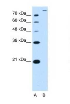 Western Blot: SLC26A5 Antibody [NBP1-59791]