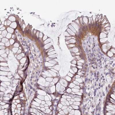 Immunohistochemistry-Paraffin: SLC26A6 Antibody [NBP2-47273]