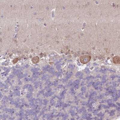 Immunohistochemistry-Paraffin: SLC26A6 Antibody [NBP2-47273]