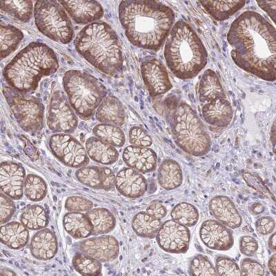 Immunohistochemistry-Paraffin: SLC26A6 Antibody [NBP2-47273]