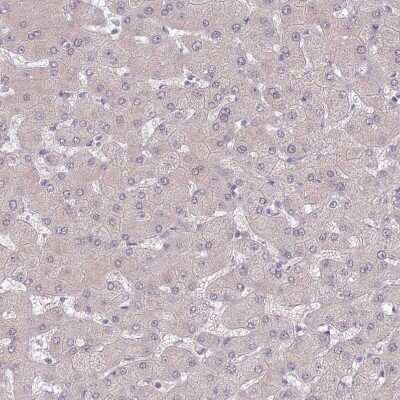 Immunohistochemistry-Paraffin: SLC26A6 Antibody [NBP2-47273]