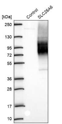 Western Blot: SLC26A6 Antibody [NBP2-47273]