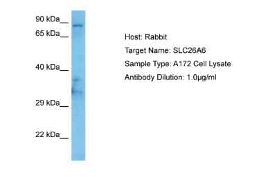 Western Blot: SLC26A6 Antibody [NBP2-88293]