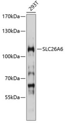 Western Blot: SLC26A6 AntibodyBSA Free [NBP2-93440]