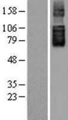 Western Blot: SLC26A6 Overexpression Lysate [NBL1-16078]