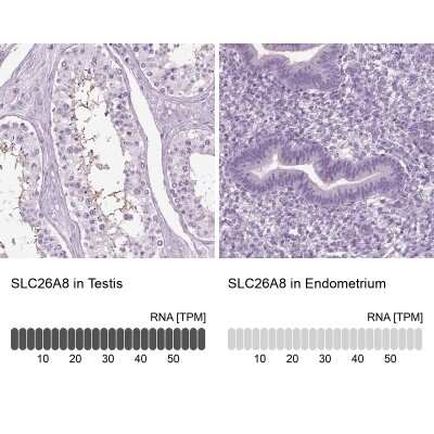 Immunohistochemistry-Paraffin: SLC26A8 Antibody [NBP1-87419]