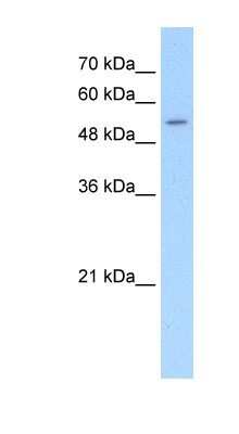 Western Blot: SLC26A8 Antibody [NBP1-70717]