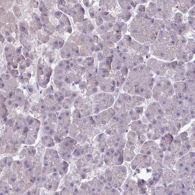 Immunohistochemistry-Paraffin: SLC26A9 Antibody [NBP2-30425]