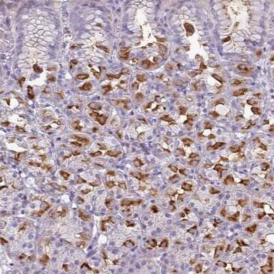 Immunohistochemistry-Paraffin: SLC26A9 Antibody [NBP2-30425]
