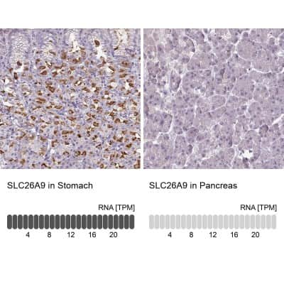 Immunohistochemistry-Paraffin: SLC26A9 Antibody [NBP2-30425]