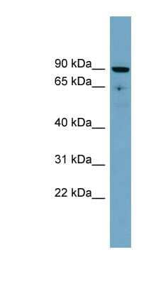 Western Blot: SLC26A9 Antibody [NBP1-59514]