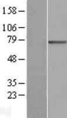 Western Blot: FATP3/SLC27A3 Overexpression Lysate [NBL1-16081]