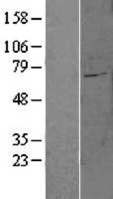 Western Blot: FATP6/SLC27A6 Overexpression Lysate [NBL1-16083]