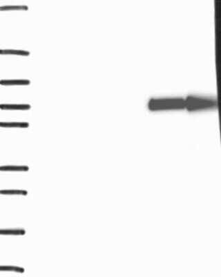 Western Blot: SLC28A1 Antibody [NBP3-17620]