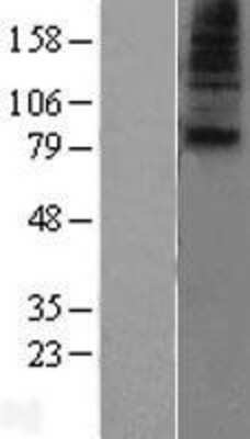 Western Blot: SLC28A1 Overexpression Lysate [NBL1-16085]