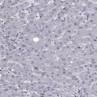 Immunohistochemistry-Paraffin: SLC28A2 Antibody [NBP2-33451]