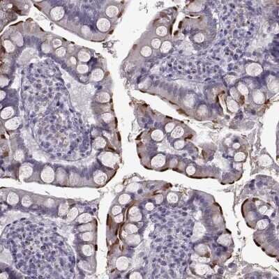 Immunohistochemistry-Paraffin: SLC28A2 Antibody [NBP2-33451]