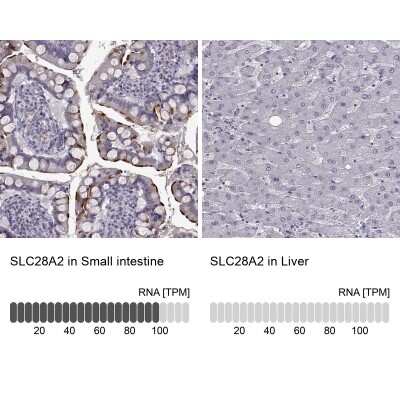 Immunohistochemistry-Paraffin: SLC28A2 Antibody [NBP2-33451]