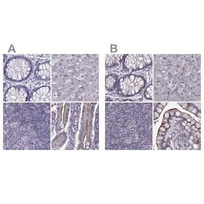 Immunohistochemistry-Paraffin: SLC28A2 Antibody [NBP2-33451]